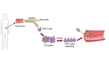 细胞治疗的前沿领域：TCR-T细胞疗法